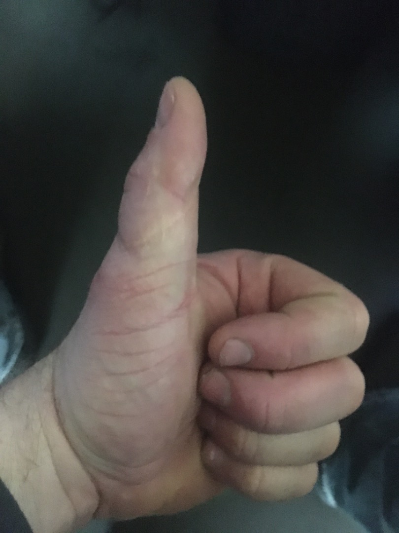 Customer review photo