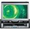 Kenwood Excelon KVT-911DVD